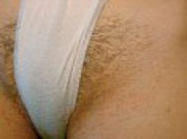 Epilation du maillot femme avant